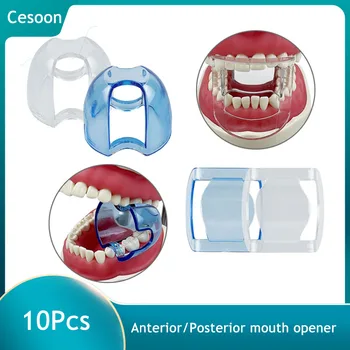 10vnt Dantų Intraoral Skruosto Susitraukimo Lūpų, Burnos Opener Priekinės/Krūminių Dantų Ortodontinis Expander Stomatologas Medžiagos
